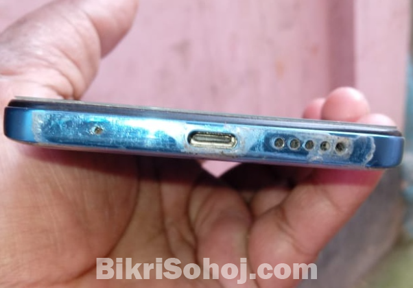 Redmi Note 11